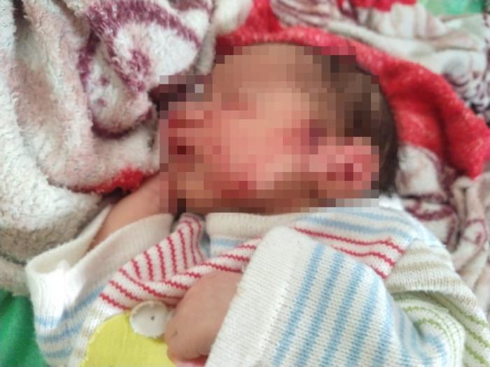 Laudo do IML aponta que recém-nascido foi mordido por ratos em Gravatá