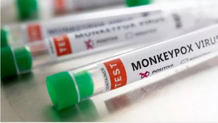 Surubim tem caso confirmado da varíola dos macacos, afirma SES-PE